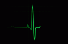 heartbeat.gif